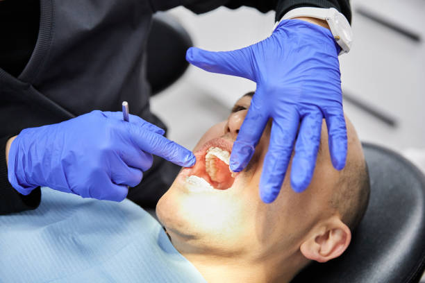 Best Emergency Tooth Extraction in Memphis, MO